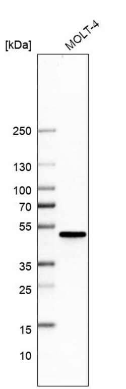 Invitrogen CtBP1 Polyclonal Antibody 100 &mu;L; Unconjugated:Antibodies,