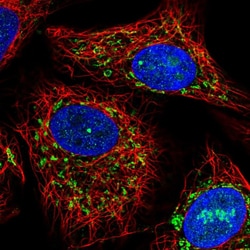 Invitrogen ACADVL Polyclonal Antibody 100 &mu;L; Unconjugated:Antibodies,