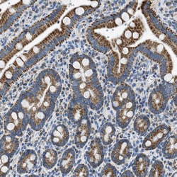 Invitrogen ACADVL Polyclonal Antibody 100 &mu;L; Unconjugated:Antibodies,