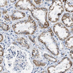 Invitrogen ACADVL Polyclonal Antibody 100 &mu;L; Unconjugated:Antibodies,
