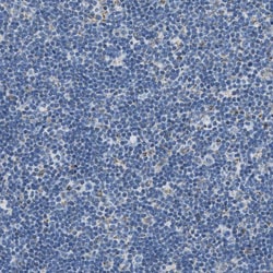 Invitrogen ACADVL Polyclonal Antibody 100 &mu;L; Unconjugated:Antibodies,