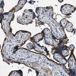 Invitrogen ACADVL Polyclonal Antibody 100 &mu;L; Unconjugated:Antibodies,
