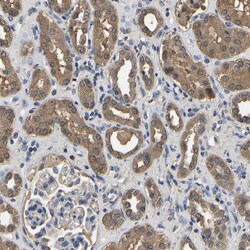 Invitrogen LDHB Polyclonal Antibody 100 &mu;L; Unconjugated:Antibodies,