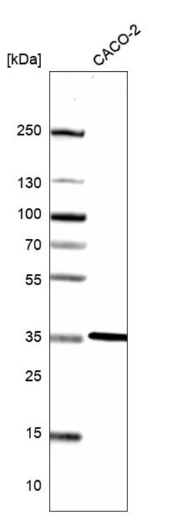 Invitrogen LDHB Polyclonal Antibody 100 &mu;L; Unconjugated:Antibodies,