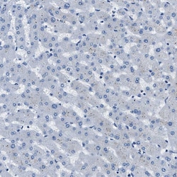 Invitrogen CAPG Polyclonal Antibody 100 &mu;L | Buy Online | Invitrogen&trade; | Fisher Scientific