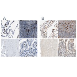 Invitrogen CAPG Polyclonal Antibody 100 &mu;L | Buy Online | Invitrogen&trade; | Fisher Scientific