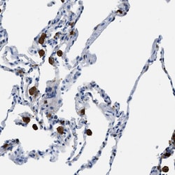 Invitrogen CAPG Polyclonal Antibody 100 &mu;L | Buy Online | Invitrogen&trade; | Fisher Scientific