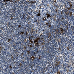 Invitrogen CAPG Polyclonal Antibody 100 &mu;L | Buy Online | Invitrogen&trade; | Fisher Scientific