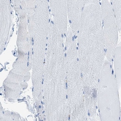 Invitrogen CAPG Polyclonal Antibody 100 &mu;L | Buy Online | Invitrogen&trade; | Fisher Scientific