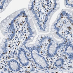 Invitrogen CAPG Polyclonal Antibody 100 &mu;L | Buy Online | Invitrogen&trade; | Fisher Scientific