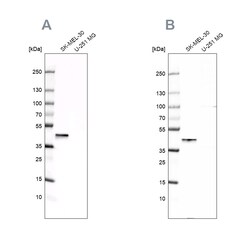 Invitrogen CAPG Polyclonal Antibody 100 &mu;L | Buy Online | Invitrogen&trade; | Fisher Scientific