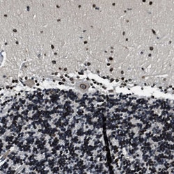 Invitrogen NIPA Polyclonal Antibody 100 &mu;L; Unconjugated:Antibodies,