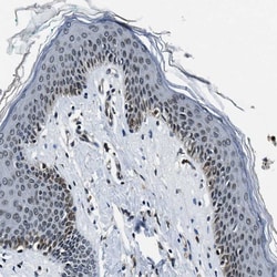 Invitrogen NIPA Polyclonal Antibody 100 &mu;L; Unconjugated:Antibodies,