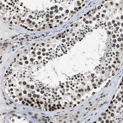 Invitrogen NIPA Polyclonal Antibody 100 &mu;L; Unconjugated:Antibodies,