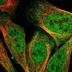Invitrogen DSCAM Polyclonal Antibody 100 &mu;L; Unconjugated:Antibodies,