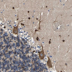 Invitrogen DSCAM Polyclonal Antibody 100 &mu;L; Unconjugated:Antibodies,
