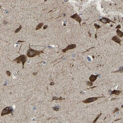 Invitrogen DSCAM Polyclonal Antibody 100 &mu;L; Unconjugated:Antibodies,