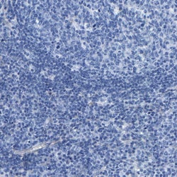 Invitrogen DSCAM Polyclonal Antibody 100 &mu;L; Unconjugated:Antibodies,