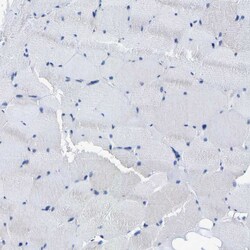 Invitrogen DSCAM Polyclonal Antibody 100 &mu;L; Unconjugated:Antibodies,