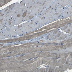 Invitrogen SLC4A2 Polyclonal Antibody 100 &mu;L; Unconjugated:Antibodies,