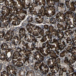 Invitrogen SLC4A2 Polyclonal Antibody 100 &mu;L; Unconjugated:Antibodies,