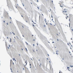 Invitrogen Aconitase 1 Polyclonal Antibody 100 &mu;L | Buy Online | Invitrogen&trade; | Fisher Scientific