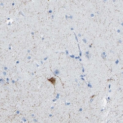 Invitrogen Somatostatin Polyclonal Antibody 100 &mu;L; Unconjugated:Antibodies,