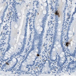 Invitrogen Somatostatin Polyclonal Antibody 100 &mu;L; Unconjugated:Antibodies,