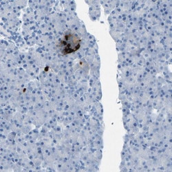 Invitrogen Somatostatin Polyclonal Antibody 100 &mu;L; Unconjugated:Antibodies,
