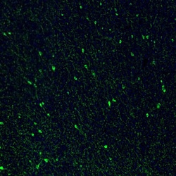 Invitrogen Somatostatin Polyclonal Antibody 100 &mu;L; Unconjugated:Antibodies,