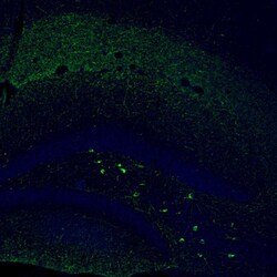 Invitrogen Somatostatin Polyclonal Antibody 100 &mu;L; Unconjugated:Antibodies,