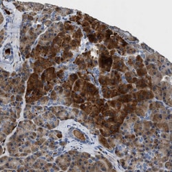 Invitrogen SLIT2 Polyclonal Antibody 100 &mu;L; Unconjugated:Antibodies,