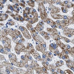 Invitrogen AMACR Polyclonal Antibody 100 &mu;L | Buy Online | Invitrogen&trade; | Fisher Scientific