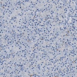 Invitrogen AMACR Polyclonal Antibody 100 &mu;L | Buy Online | Invitrogen&trade; | Fisher Scientific
