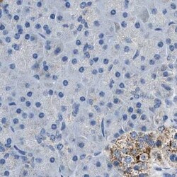Invitrogen AMACR Polyclonal Antibody 100 &mu;L | Buy Online | Invitrogen&trade; | Fisher Scientific