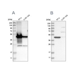 Invitrogen AMACR Polyclonal Antibody 100 &mu;L | Buy Online | Invitrogen&trade; | Fisher Scientific