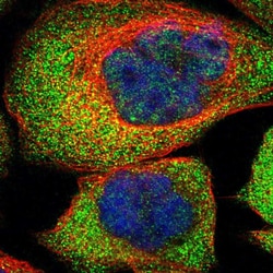 Invitrogen AKR1A1 Polyclonal Antibody 100 &mu;L; Unconjugated:Antibodies,