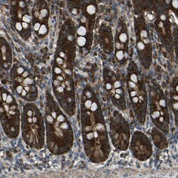 Invitrogen AKR1A1 Polyclonal Antibody 100 &mu;L; Unconjugated:Antibodies,