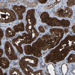 Invitrogen AKR1A1 Polyclonal Antibody 100 &mu;L; Unconjugated:Antibodies,