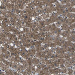 Invitrogen AKR1A1 Polyclonal Antibody 100 &mu;L; Unconjugated:Antibodies,