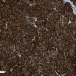 Invitrogen AKR1A1 Polyclonal Antibody 100 &mu;L; Unconjugated:Antibodies,
