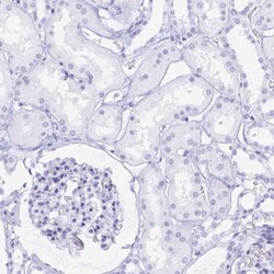 Invitrogen PLA1 Polyclonal Antibody 100 &mu;L; Unconjugated:Antibodies,