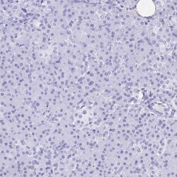 Invitrogen PLA1 Polyclonal Antibody 100 &mu;L; Unconjugated:Antibodies,