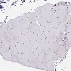 Invitrogen PLA1 Polyclonal Antibody 100 &mu;L; Unconjugated:Antibodies,