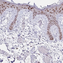Invitrogen PLA1 Polyclonal Antibody 100 &mu;L; Unconjugated:Antibodies,