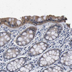 Invitrogen UCHL3 Polyclonal Antibody 100 &mu;L; Unconjugated:Antibodies,