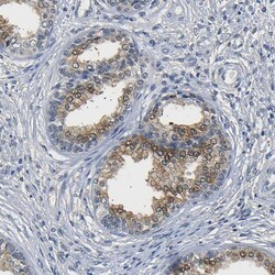 Invitrogen UCHL3 Polyclonal Antibody 100 &mu;L; Unconjugated:Antibodies,