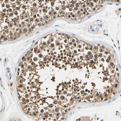 Invitrogen UCHL3 Polyclonal Antibody 100 &mu;L; Unconjugated:Antibodies,