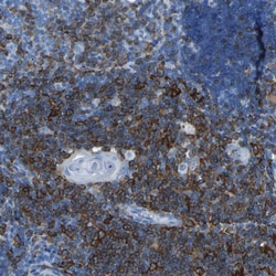 Invitrogen LSP1 Polyclonal Antibody 100 &mu;L; Unconjugated:Antibodies,