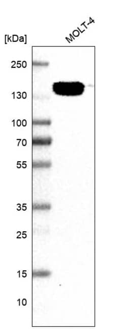 Invitrogen p130 Polyclonal Antibody 100 &mu;L; Unconjugated:Antibodies,